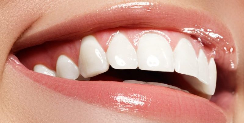teeth-whitening-journal-harley-street-emporium