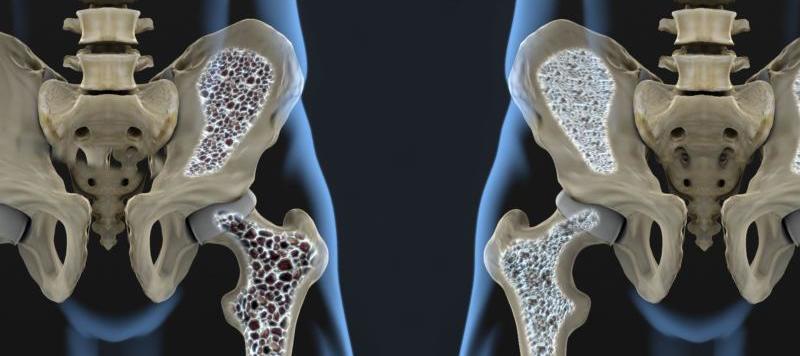 menopause-osteoporosis-harley-street-emporium