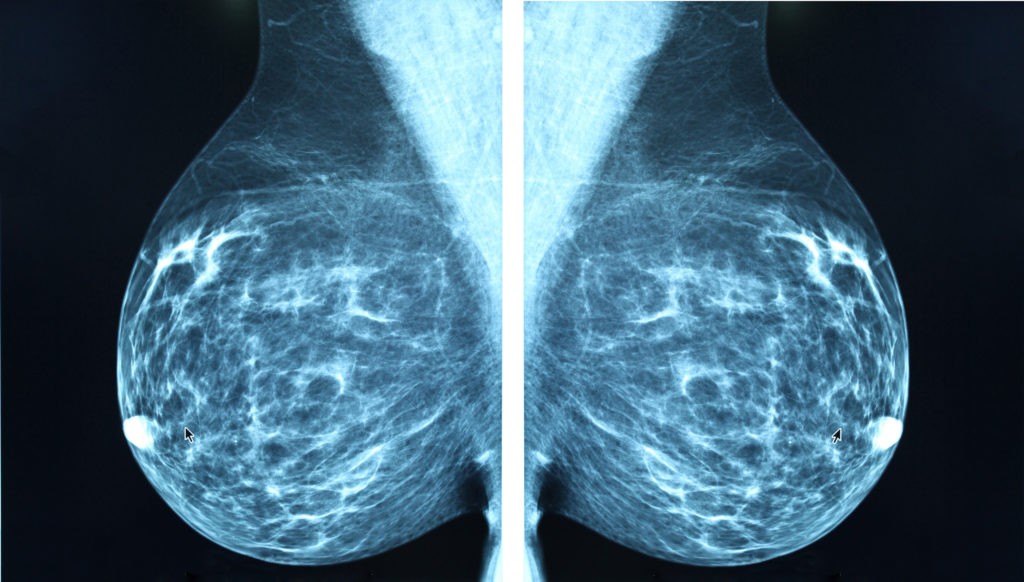 breast mammogram harley street emporium