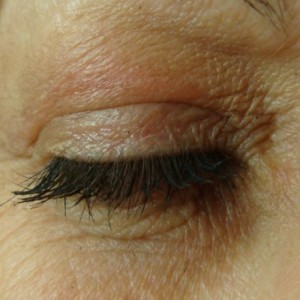 eye-after-plexr-treatments-harley-street-emporium