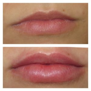 Dr Krystyna lips